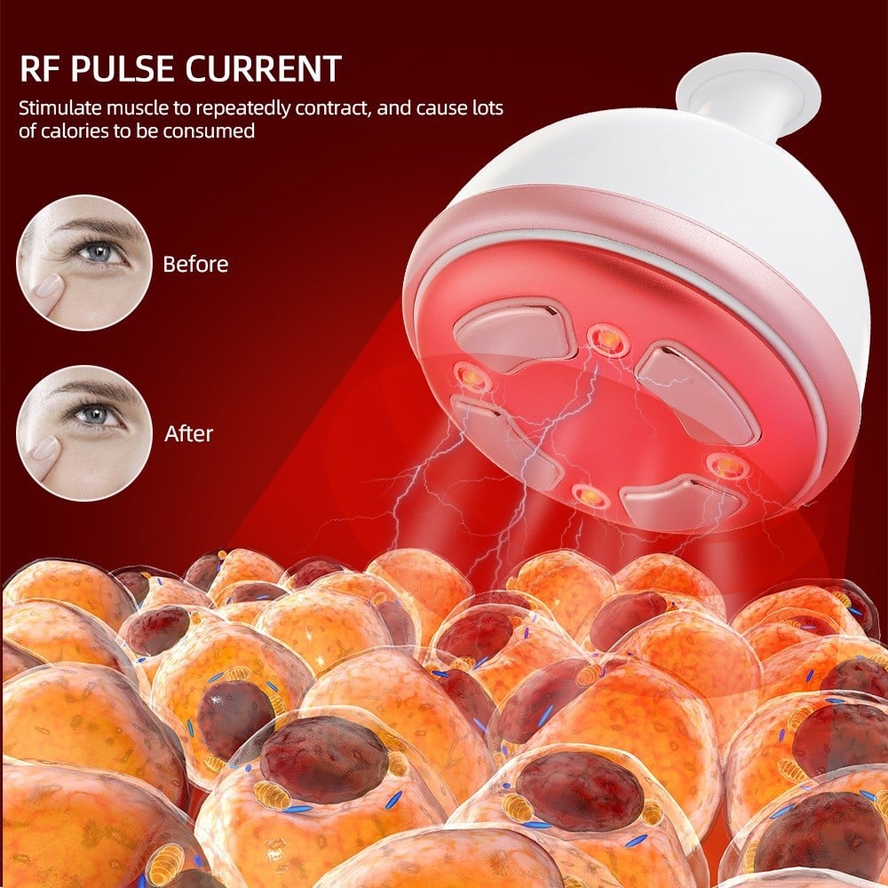 OEM Beauty Phototherapy Vibrating Massager Heating Pulse Current Reshap Sonic Weight Loss RF Body Slimming Machine插图