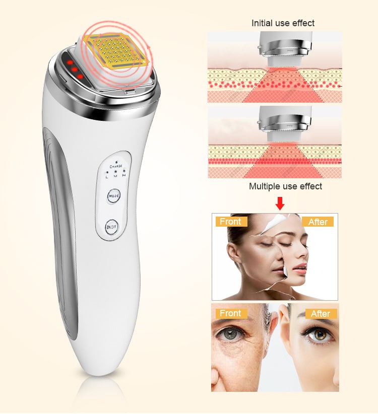 RF Facial Beauty Microneedle Contouring Device Wrinkle Remover Face Lifting Radio Frequency Skin Tightening Machine插图5