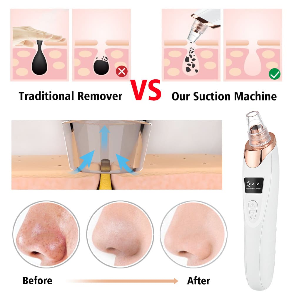 5 in 1 Wholesale Vacuum Nose Strip Power Facial Pore Cleaner Skin Beauty Machine Electric Blackhead Removal插图1