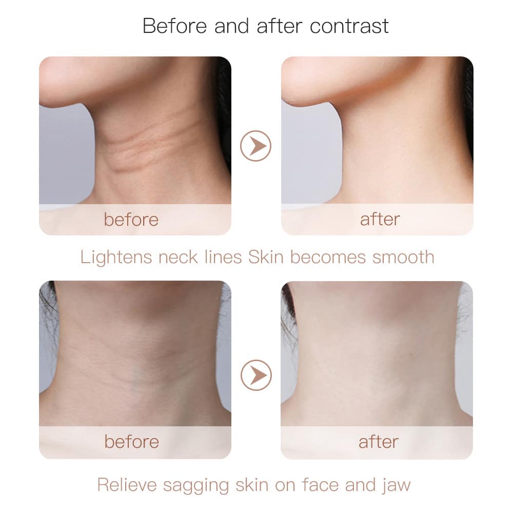 Microcurrent Neck Beauty Lifting Device Vibrating LED Light Technology Skin Firming Wrinkle Remover Face & Neck Massager插图2
