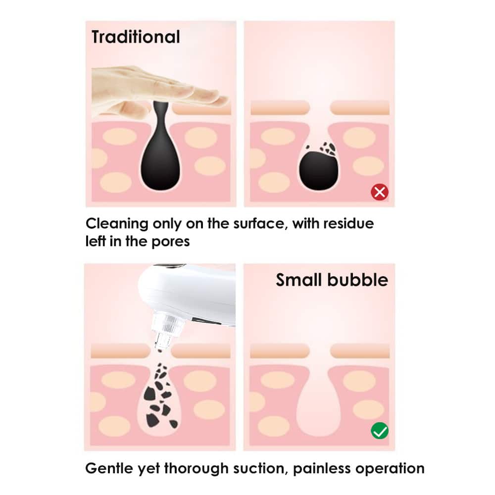 Water Spray 4 in 1 Electric Peeling Beauty Machine Skin Scrubber Nose Strip Vacuum Facial Pore Cleaner Blackhead Remover插图4