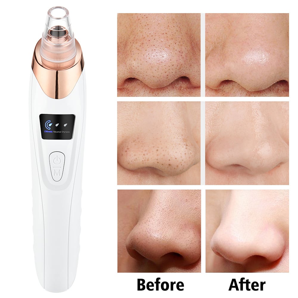 5 in 1 Wholesale Vacuum Nose Strip Power Facial Pore Cleaner Skin Beauty Machine Electric Blackhead Removal插图4