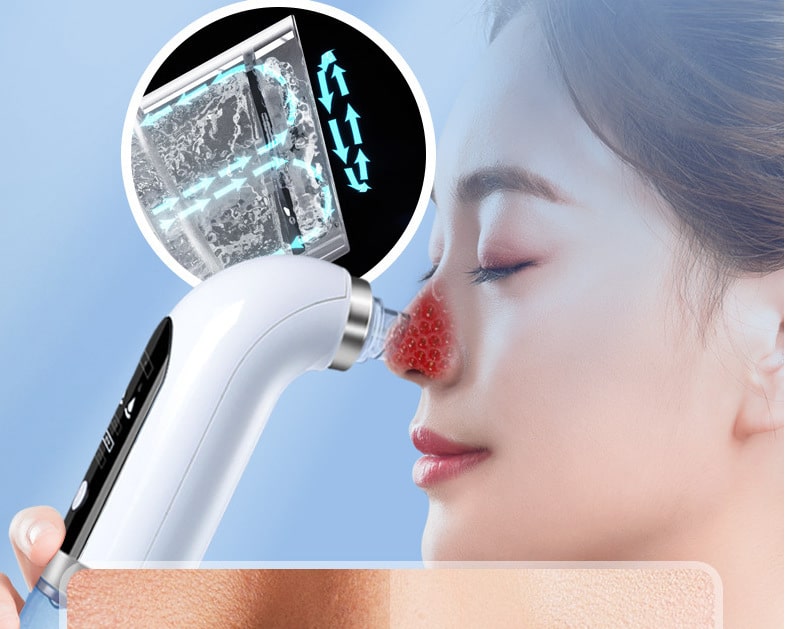 Portable Nose Strip Facial Cleaner Blackheads Remover with Vacuum Suction Beauty Skin Acne Pore Vacuum Blackhead Remover插图6