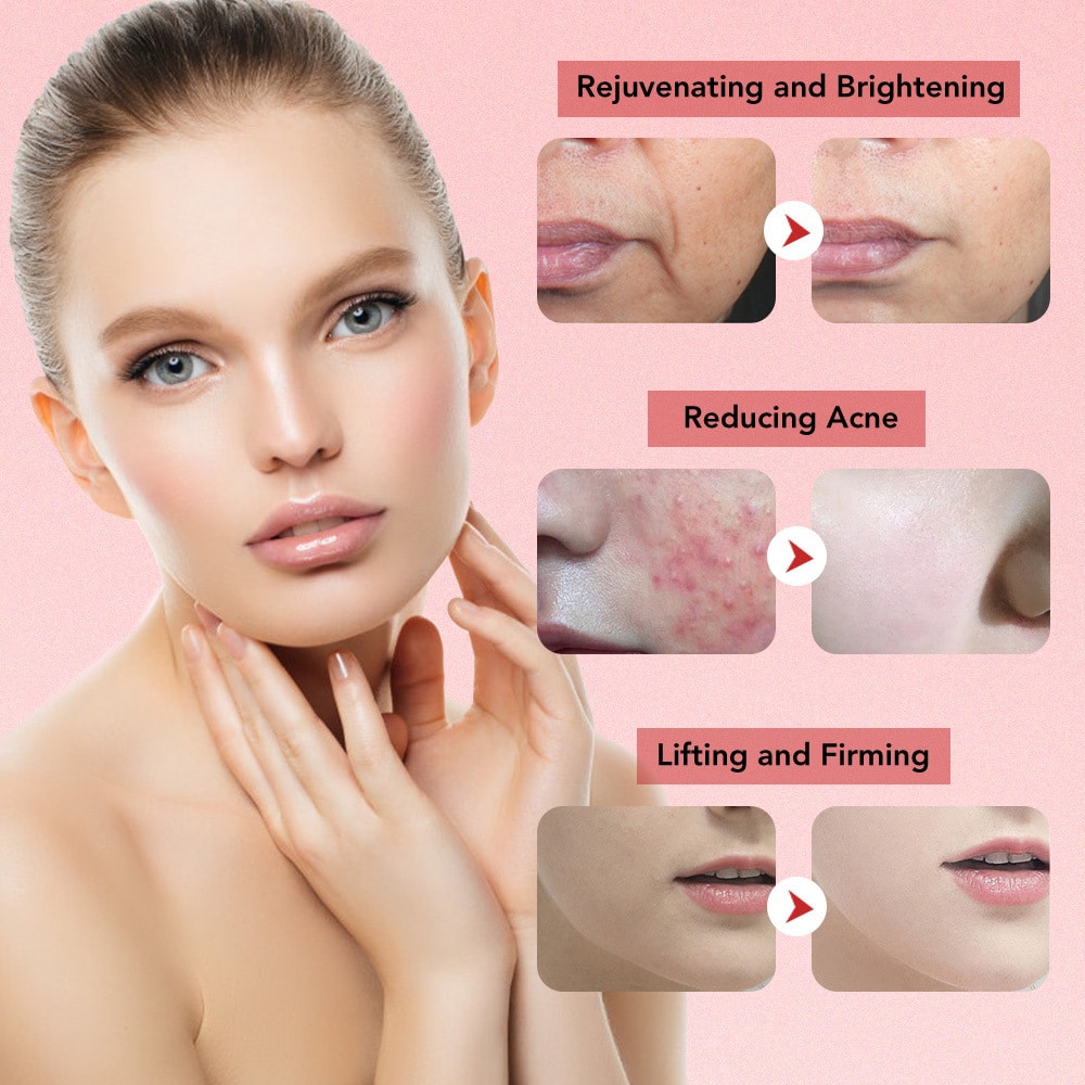 OEM 7 IN 1 Facial Beauty Light Wrinkle Remover Massager Face Lift Skin Rejuvenation Equipment EMS Slimming Machine插图5