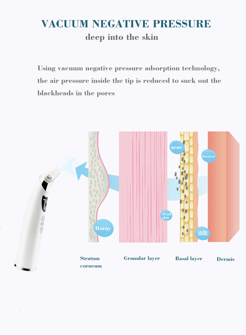 5 in 1 Nose Strip Blackheads with Vacuum Suction Electric Face Cleaner Skin Beauty Acne Pore Vacuum Blackhead Remover插图8