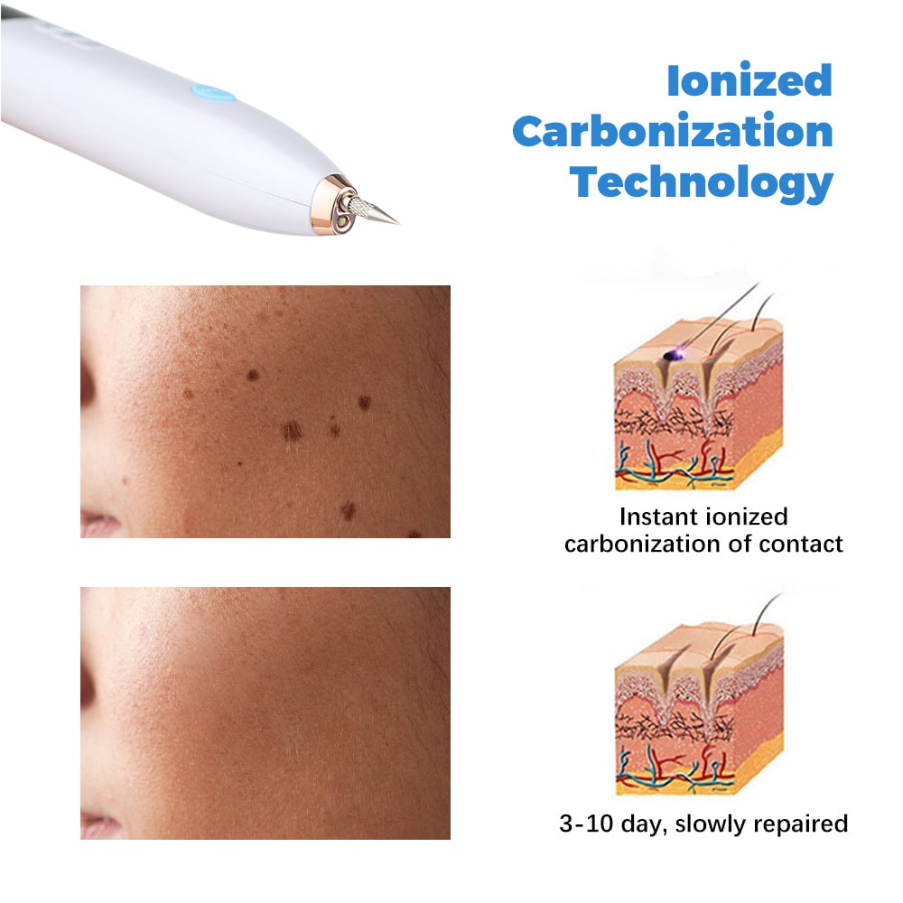 LCD Display Skin Beauty Care Laser Plasma Pen Mole Tattoo Freckle Removal Pen插图1