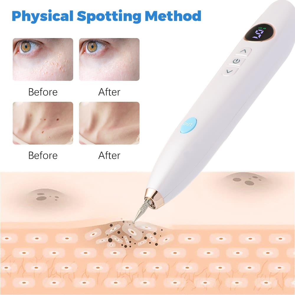 LCD Display Skin Beauty Care Laser Plasma Pen Mole Tattoo Freckle Removal Pen插图3